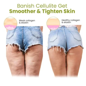 Oveallgo™ Ex HerbalFirm Cellulite Reduction Patches