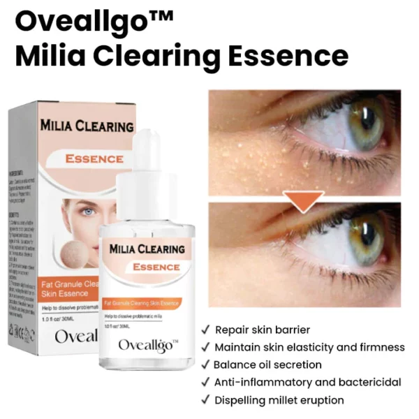 Oveallgo™ Milia Clearing Essence - Image 3