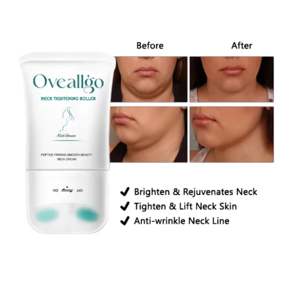 Oveallgo™ Neck Tightening Roller