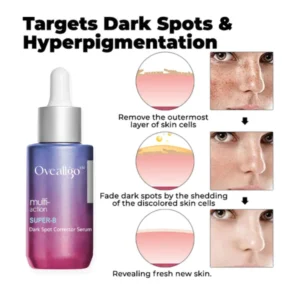 Oveallgo™ Super-B Dark Spot Corrector Serum