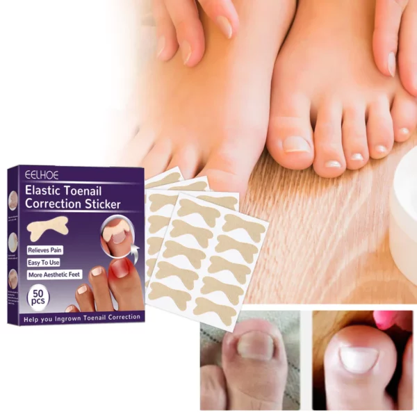 PARONYCHIA REPAIR NAIL ELASTIC CORRECTIVE PATCH