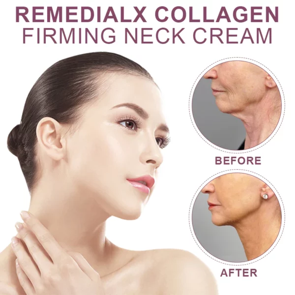 REMEDIALX CollagenFirming Neck Cream