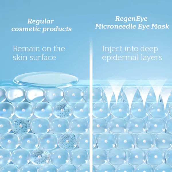 RegenEye™ Microneedle Eye Mask - Image 2