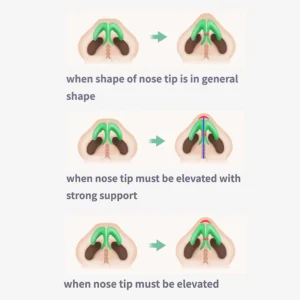 Sci-Effect™ Nose Lift Shaping Oil