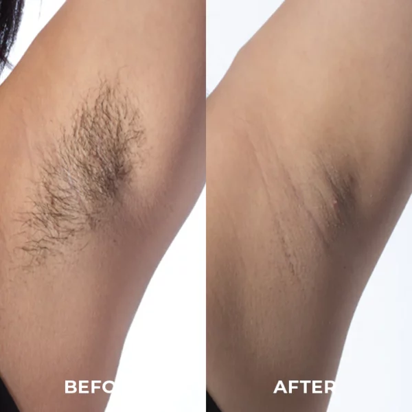 Skinetic™ Advanced Hair Removal Cream - Image 8