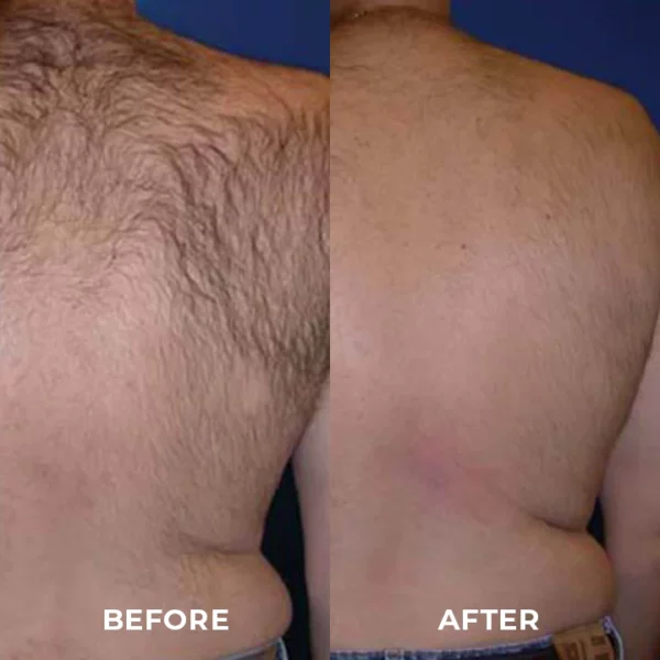 Skinetic™ Advanced Hair Removal Cream - Image 9