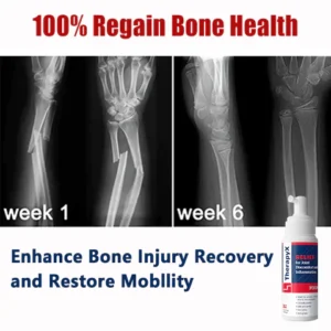 TherapyX™ Joint & Bone Therapy Foam