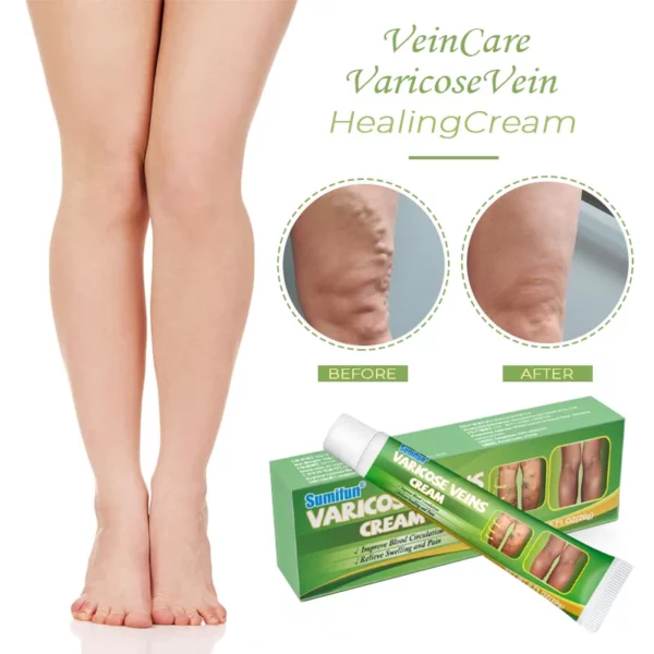 VeinCare VaricoseVein Healing Cream - Image 2