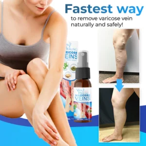 Veinhealing Varicose Veins Treatment Spray