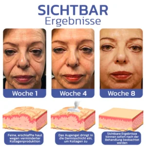 flysmus™ BIGEYES Straffende Creme zur Definition der Augenlider