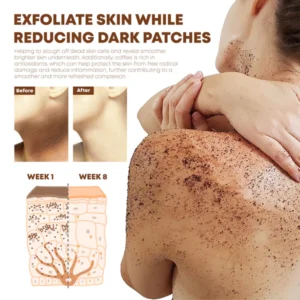 ATTDX Coffee Acanthosis Nigricans BodyScrub