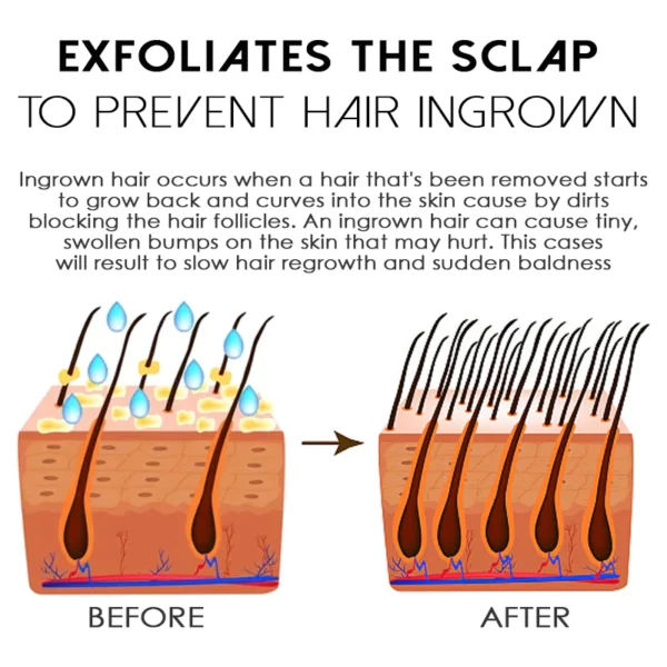 ATTDX HairReborn Minoxidil Growth Roller - Image 2