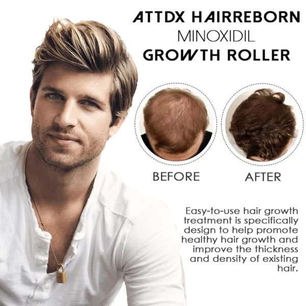 ATTDX HairReborn Minoxidil Growth Roller - Image 3