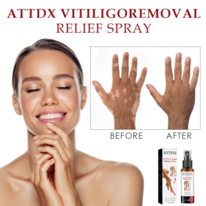 ATTDX VitiligoRemoval Relief Spray