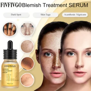 Blemish Treatment Serum