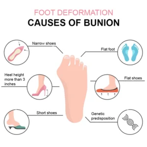 Bunion Patch