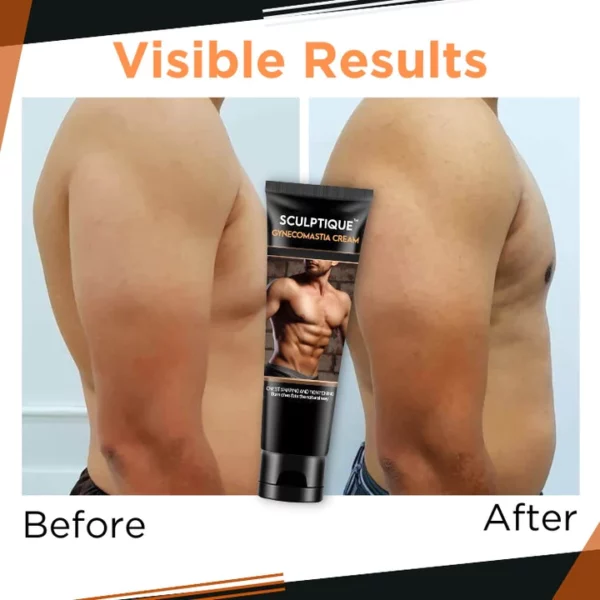 CC™ Gynecomastia Cream - Image 3