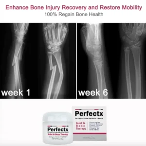 CC™ Perfectx Joint And Bone Therapy Cream