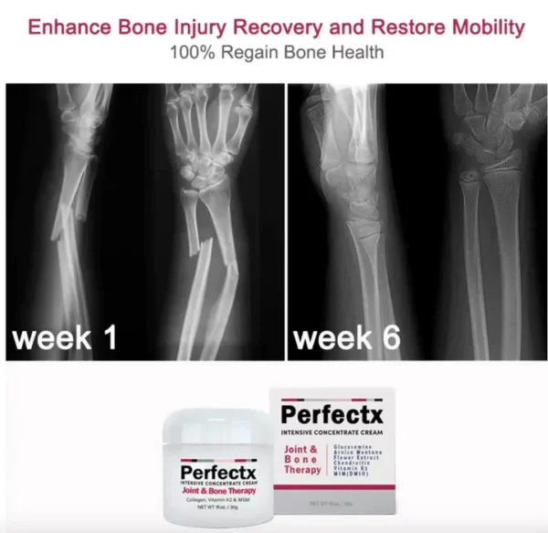 CC™ Perfectx Joint And Bone Therapy Cream