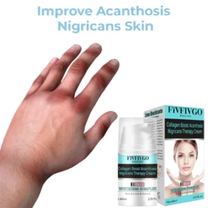 Fivfivgo™ Collagen Boost Acanthosis Nigricans Therapiecreme