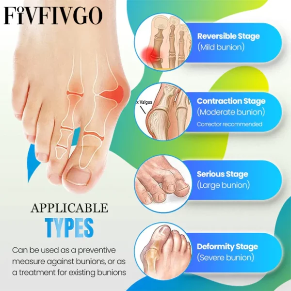 Fivfivgo™ Gesundheitssocke gegen Ballen und Krampfadern - Image 6