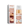 GFOUK™ AcanthoClear Therapie-Spray