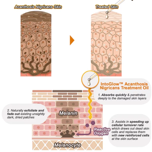 IntoGlow™ Acanthosis Nigricans Treatment Oil - Image 2