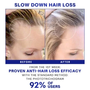 Juenow™ HairGrowth Formula Serum Spray