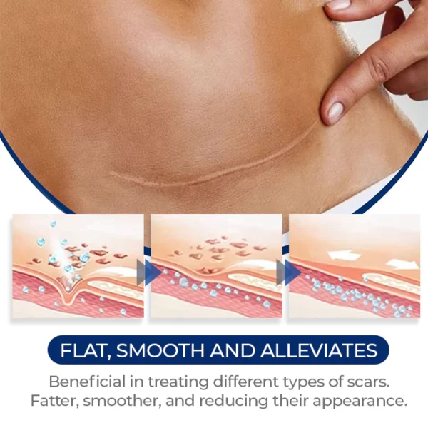 MEDix™ Advanced Silicone Scar Gel