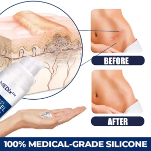 MEDix™ Advanced Silicone Scar Gel