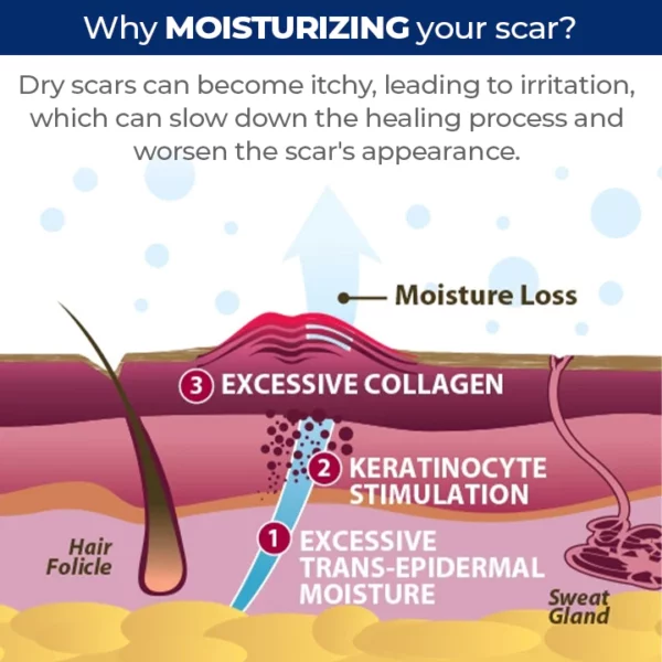 MEDix™ Advanced Silicone Scar Gel