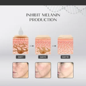 MelaGlow™ Intensive Facial Correcting Serum