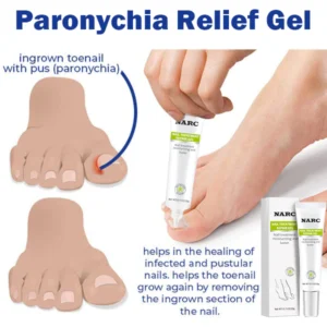 NARC™ Removal Paronychia Gel