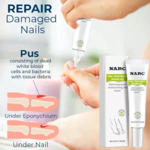 NARC™ Removal Paronychia Gel