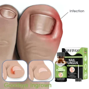 Oveallgo™ FootCure Removal Paronychia Gel