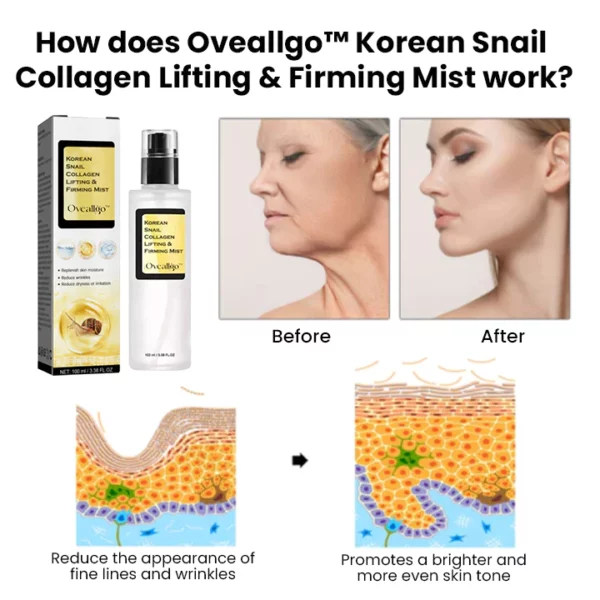 Oveallgo™ Korean Snail Collagen Lifting & Firming Mist - Image 2