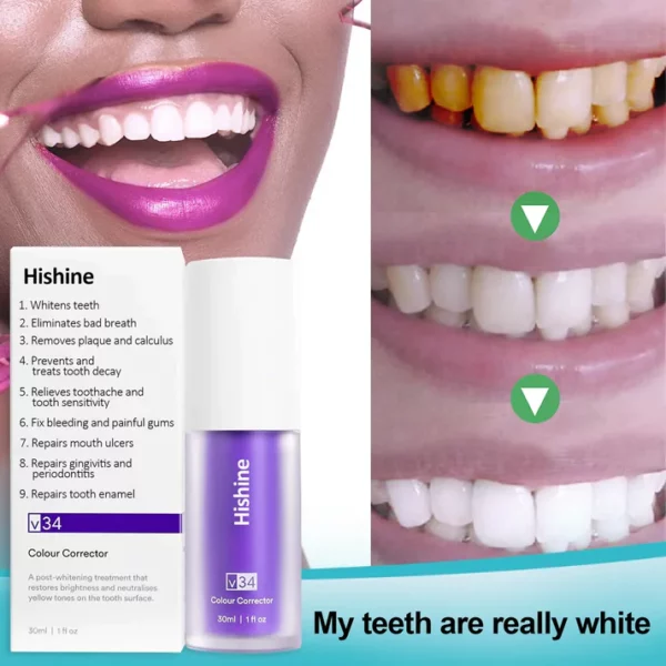 Oveallgo™ Pure Herbal Teeth Whitening Mousse - Image 3