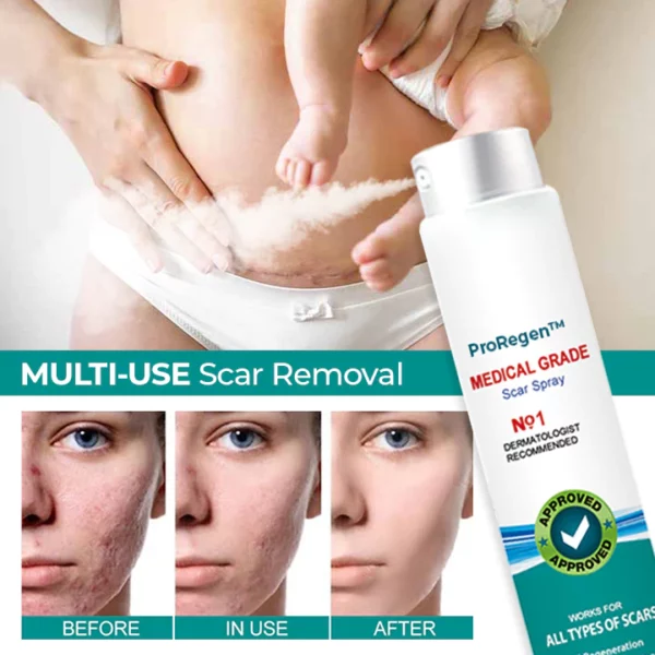 ProRegen™ Medical Scar Removal Spray