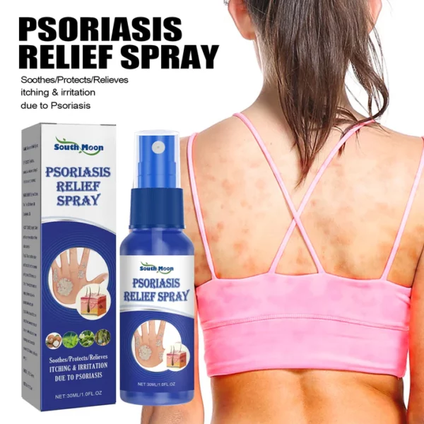 Psoriasis Relief Spray