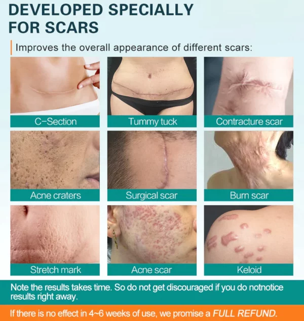 Scar Remover Gel for Scars from C-Section - Image 2