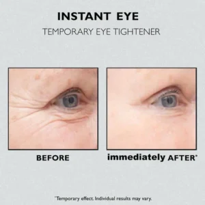 Seurico™ Instant Firm Eye Tightener