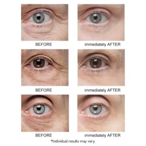 Seurico™ Instant Firm Eye Tightener