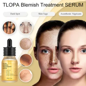 TLOPA Blemish Treatment serum