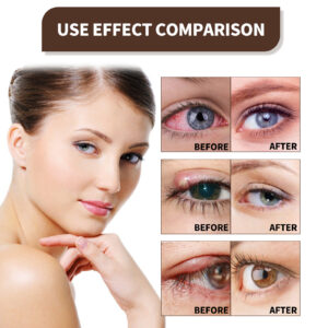 TLOPA™ Ultra Eye Therapy Drops