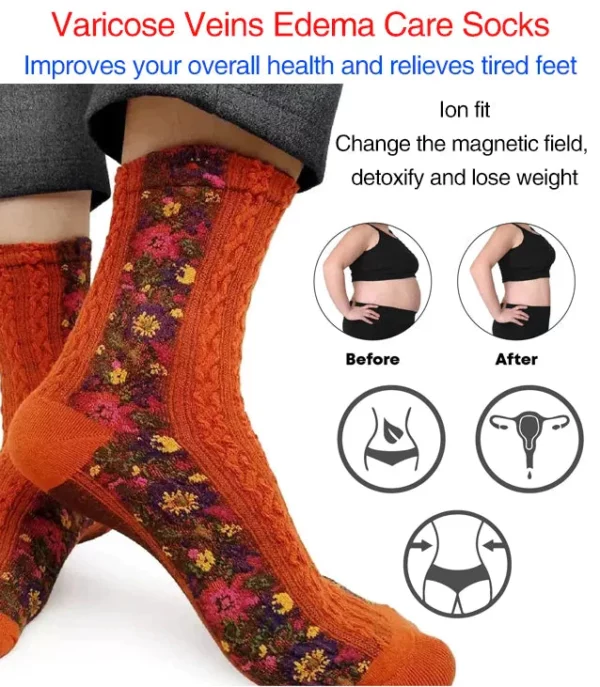 Varicose Veins Edema Care Socks