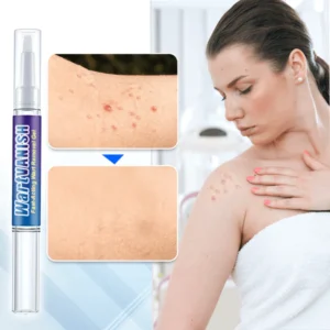 WartVanish™ Fast-Acting Wart Removal Gel