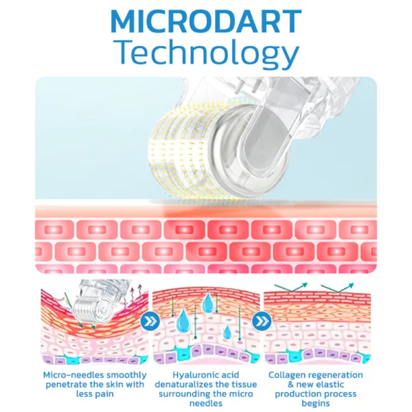 flysmus™ PockmarksHeal Collagen Hyaluronic Acid Microdart Roller - Image 3