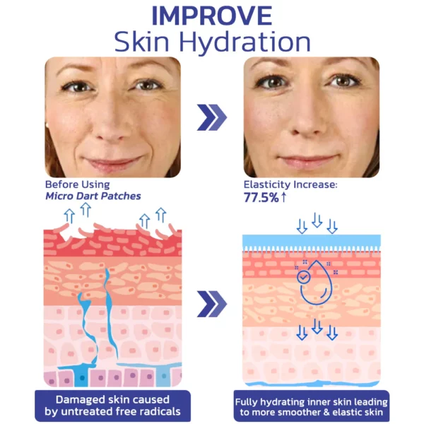 flysmus™Targetline Hyaluronic Acid Micro Dart Patches - Image 4