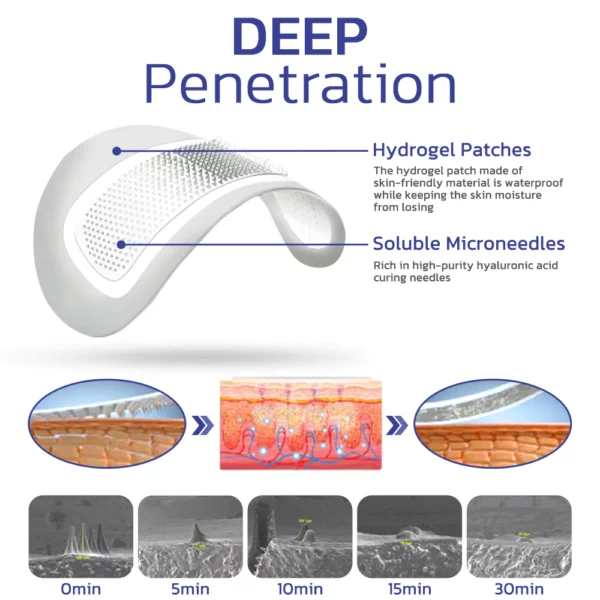 flysmus™Targetline Hyaluronic Acid Micro Dart Patches - Image 5