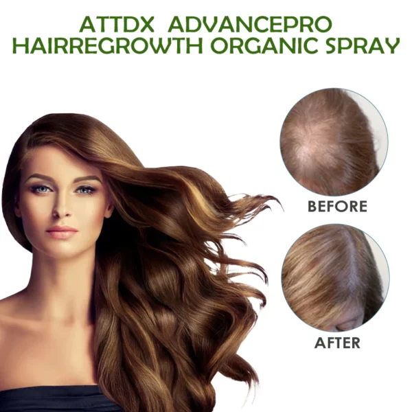 ATTDX AdvancePro HairRegrowth Organic Spray - Image 5